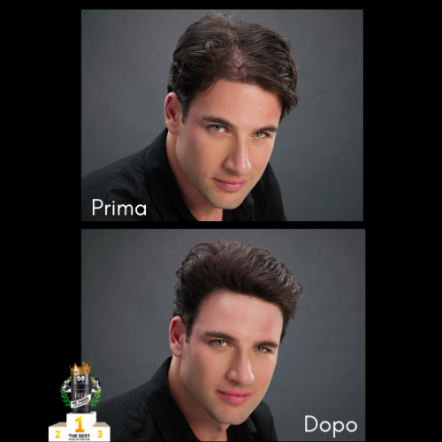 TOPPIK FIBRE CAPILLARI DENSIFICANTI 12GR